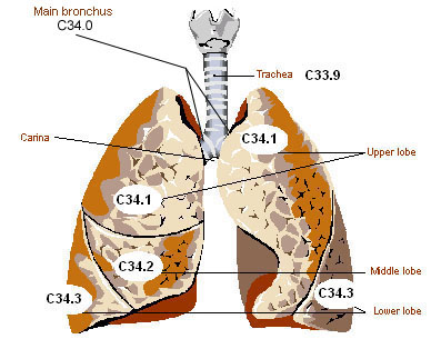 Lung Cancer icd10